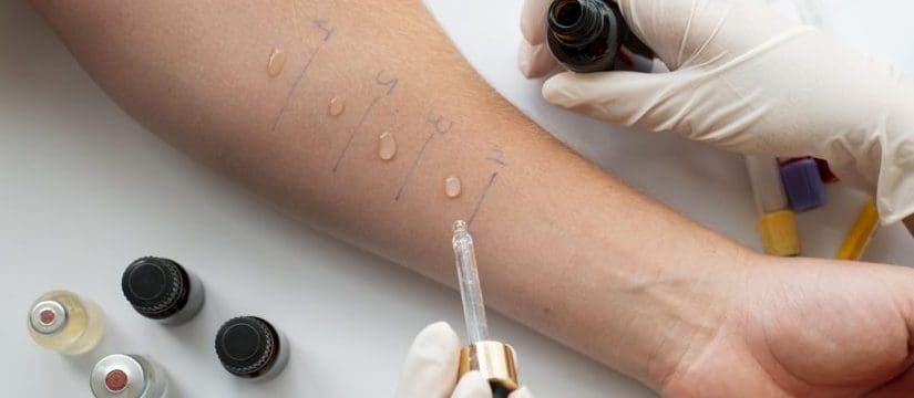 Cilat lloje të testeve përdoren për të diagnostikuar alergjitë?