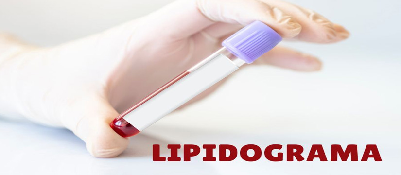 Analiza e gjakut Lipidograma
